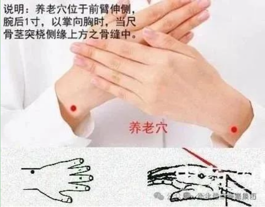 关爱老人，从穴位开始